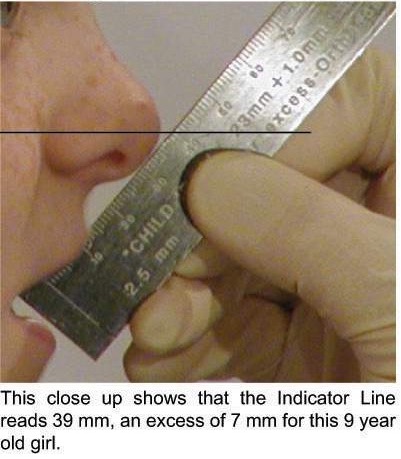 Using the Indicator Ruler